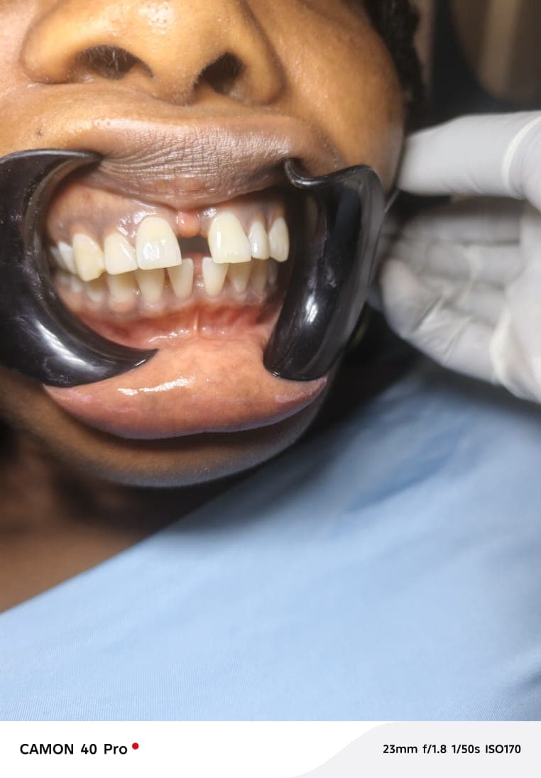 Frontal orthodontic examination