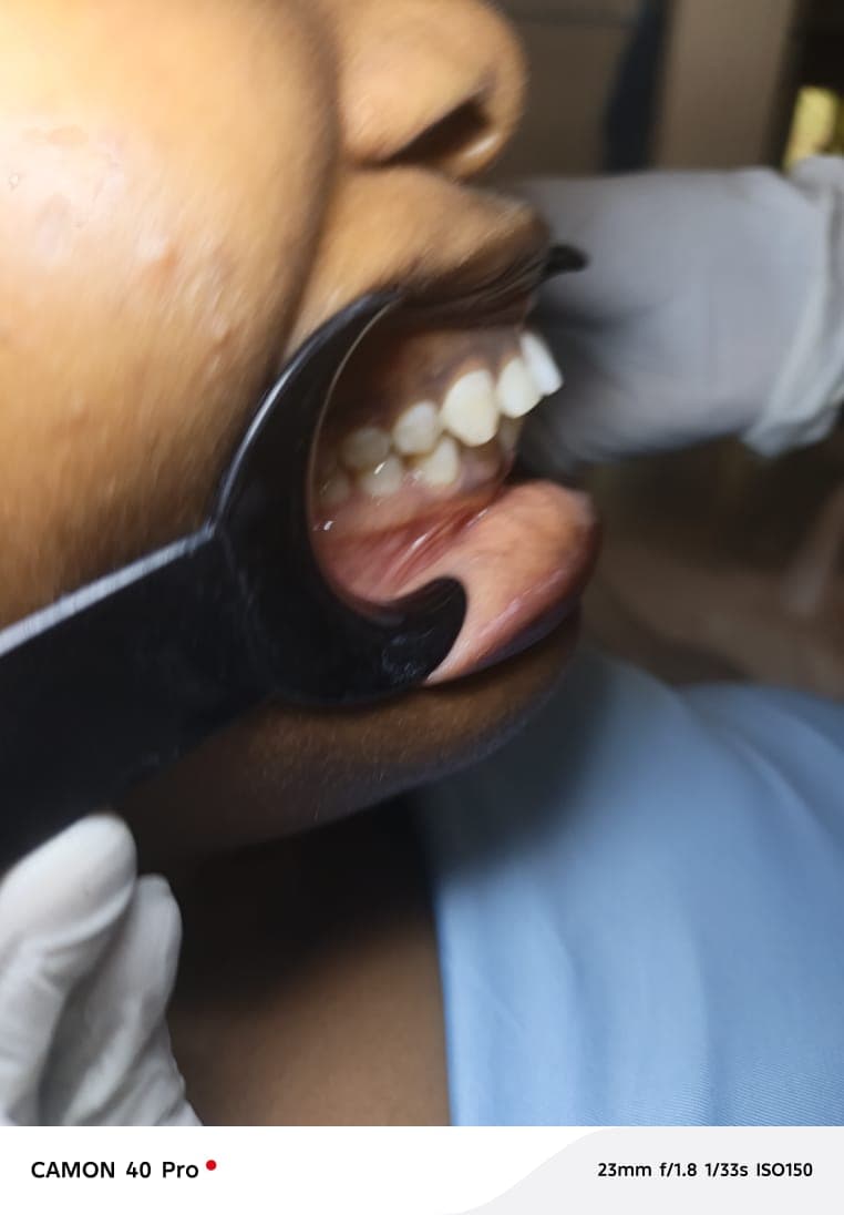 Lateral view bite examination